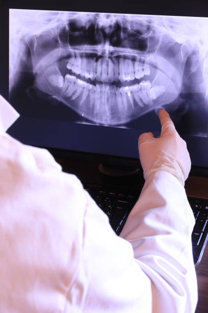 Best Chipped Tooth Repair Near Me  in Americus, GA